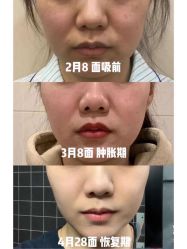 -上海漾颜医疗美容