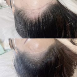 -久匠·纹眉纹绣半永久