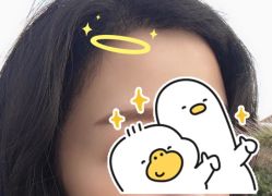 -大麦微针植发全国连锁