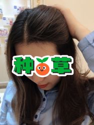 -大麦微针植发丨全国连锁