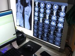 -张钰强中医正骨推拿连锁(华发商都店)