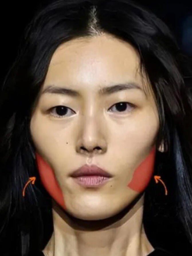 不要盲目填充面颊❌ 先弄清是哪种凹陷❗