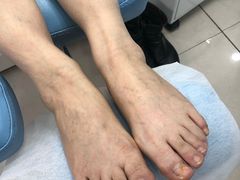 -派恩宜灰指甲(勤业店)