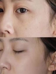 -SKINLALA美肤疗愈SPA