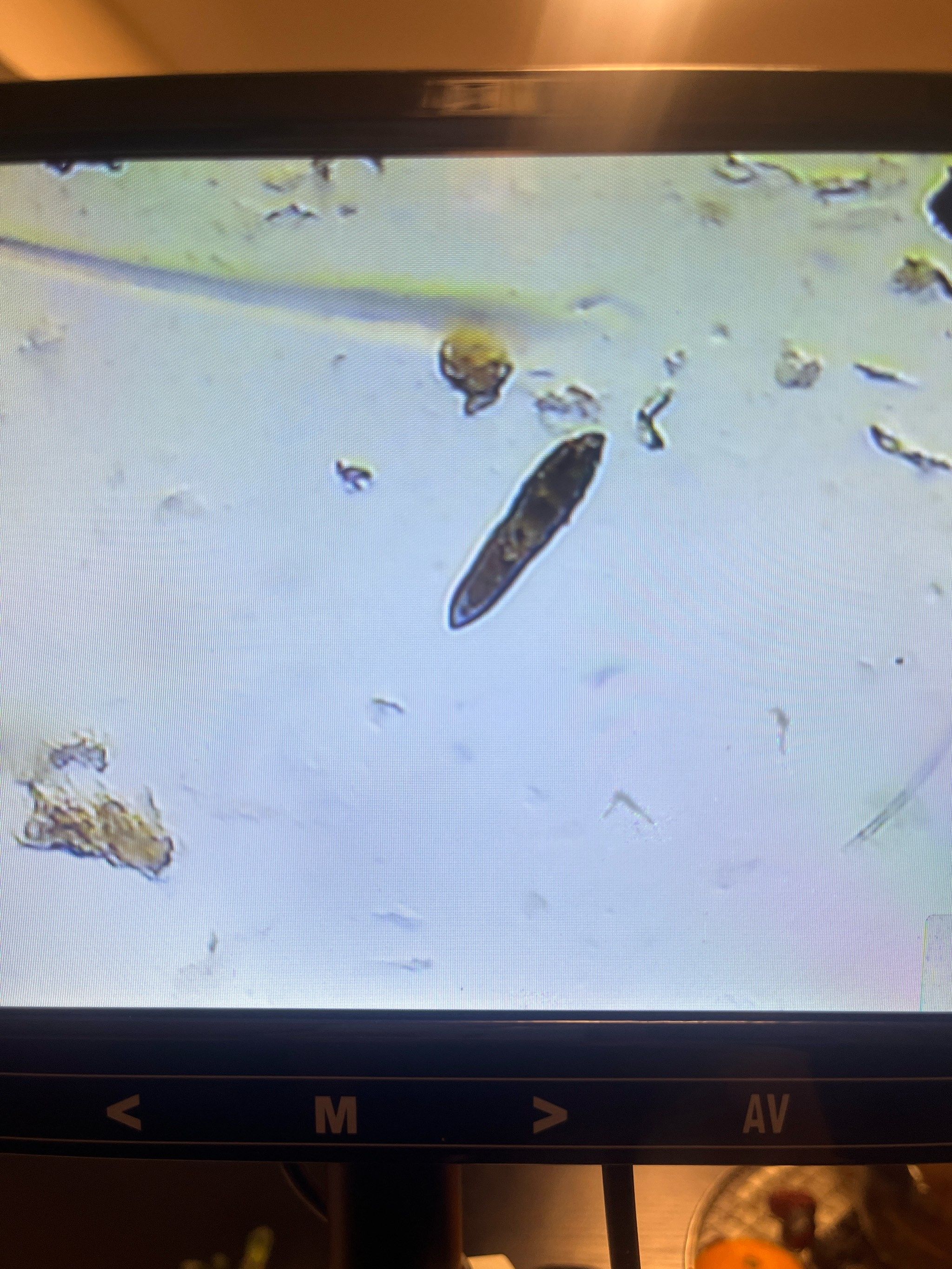 皮肤螨虫是一种微小的寄生虫,主要是毛囊蠕