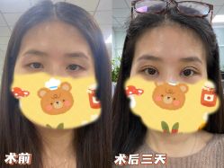 点击看大图 -美莱医学美容医院