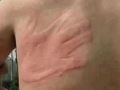 -南京鼓楼医院(鼓楼本部)