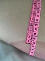 -肥三针腧穴瘦身馆