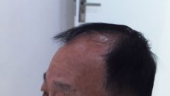 -雍禾植发全国连锁