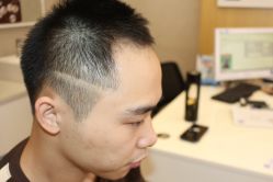 -大麦微针植发丨全国连锁