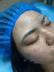 体验后-重庆军科整形美容医院