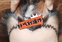 -大麦微针植发全国连锁