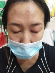 -北京美痣堂古方祛痣斑疣瘊