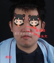 -北京米扬丽格医疗美容·联合丽格鼻整形中心