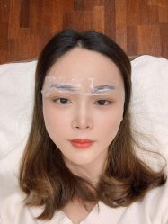 体验前-北京英煌医疗美容
