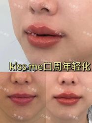 -杭州米兰柏羽医疗美容医院