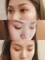 -宥莉·ULLY 痘敏肌•科技皮肤管理中心