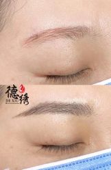 -德绣·机器野生眉发际线·美瞳线半永久