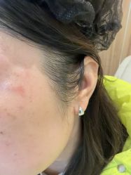 -Yestar宁波艺星整形医院