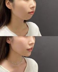 -铂特丽医美·眼鼻整形·光电美肤·注射抗衰
