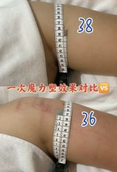-Lily纤美·科技减脂中心