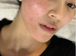 -洁铭新加坡医美