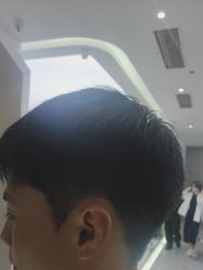 -天使之手