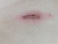 -成都军建医院·疤痕诊疗中心