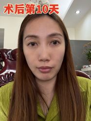 -广州健丽·去眼袋医疗美容机构