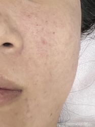体验后-北京炫美医疗美容