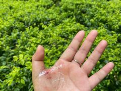 -广州市南沙区中医医院(珠江院区)