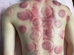 -沈师傅盲人按摩工作室(密三小区店)
