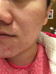 -MedSkinCare科技祛痘肌肤修护中心