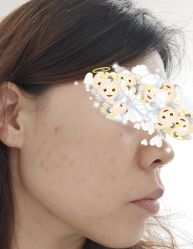 体验后-坤如玛丽·医疗美容中心