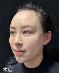 点击看大图 体验后-脸博士医疗美容·眼鼻整形·抗衰中心