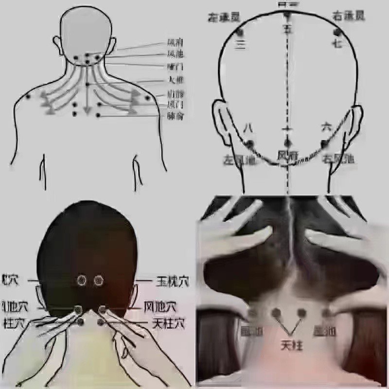 颈窝位置示意图图片