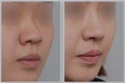 -SKINIST丽铂医疗美容