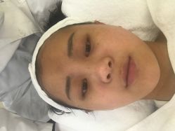 -Dr.ACNE痘院长祛痘皮肤管理连锁