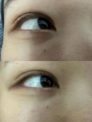 -瓷肌博士·祛痘科技美肤