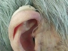 -自然之声助听器(平凉店)