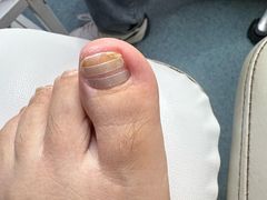 -新甲连锁灰指甲·甲沟炎·鸡眼(黑龙江路店)