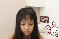 -大麦微针植发丨全国连锁