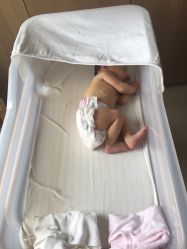 点击看大图 晒黄疸-北京明德医院