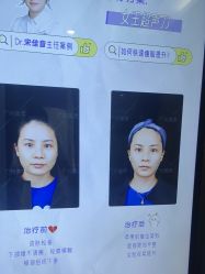 -广州美莱医疗美容医院