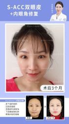 -丰联丽格医疗美容·联合丽格眼整形中心