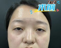 -素美医疗美容·西南眼鼻整形·修复基地