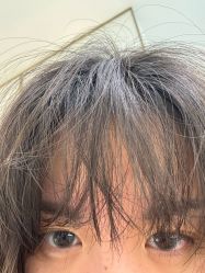 -成都西区医院整形美容