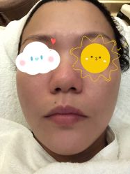 点击看大图 体验后-上海首尔丽格医疗美容医院