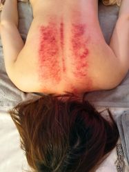 -东英经典SKIN&SPA