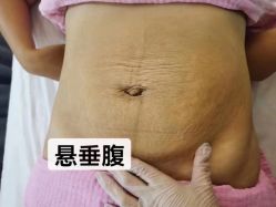 点击看大图 -产后帮产后修复(首城国际店)